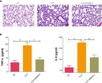 Metabolomic Analysis of the Effects of Adipose-Derived Mesenchymal Stem Cell Treatment on Rats With Sepsis-Induced Acute Lung Injury